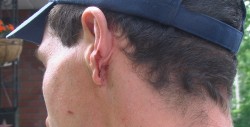 Kevin Langlois ear