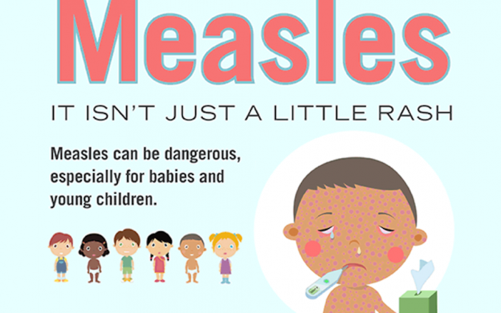 Epic Measles Outbreaks Signifies Importance of Vaccinations by Mary Anne Pankhurst 092118
